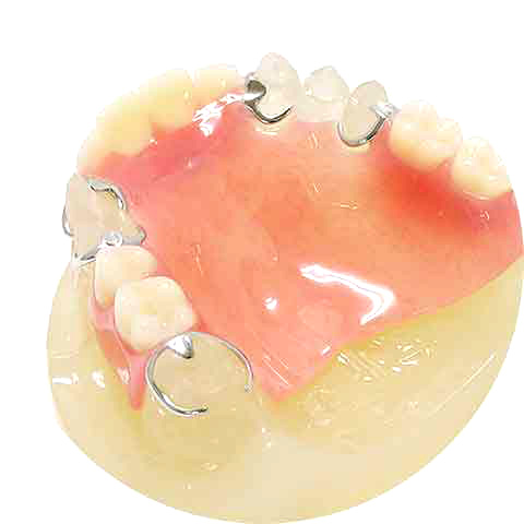 歯周病菌が増える