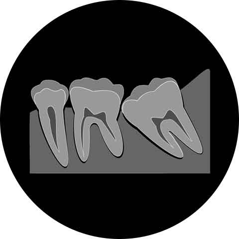 中途半端に埋もれている場合